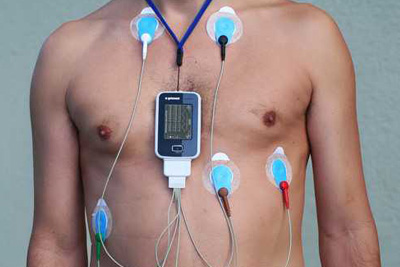 Holter Monitor
